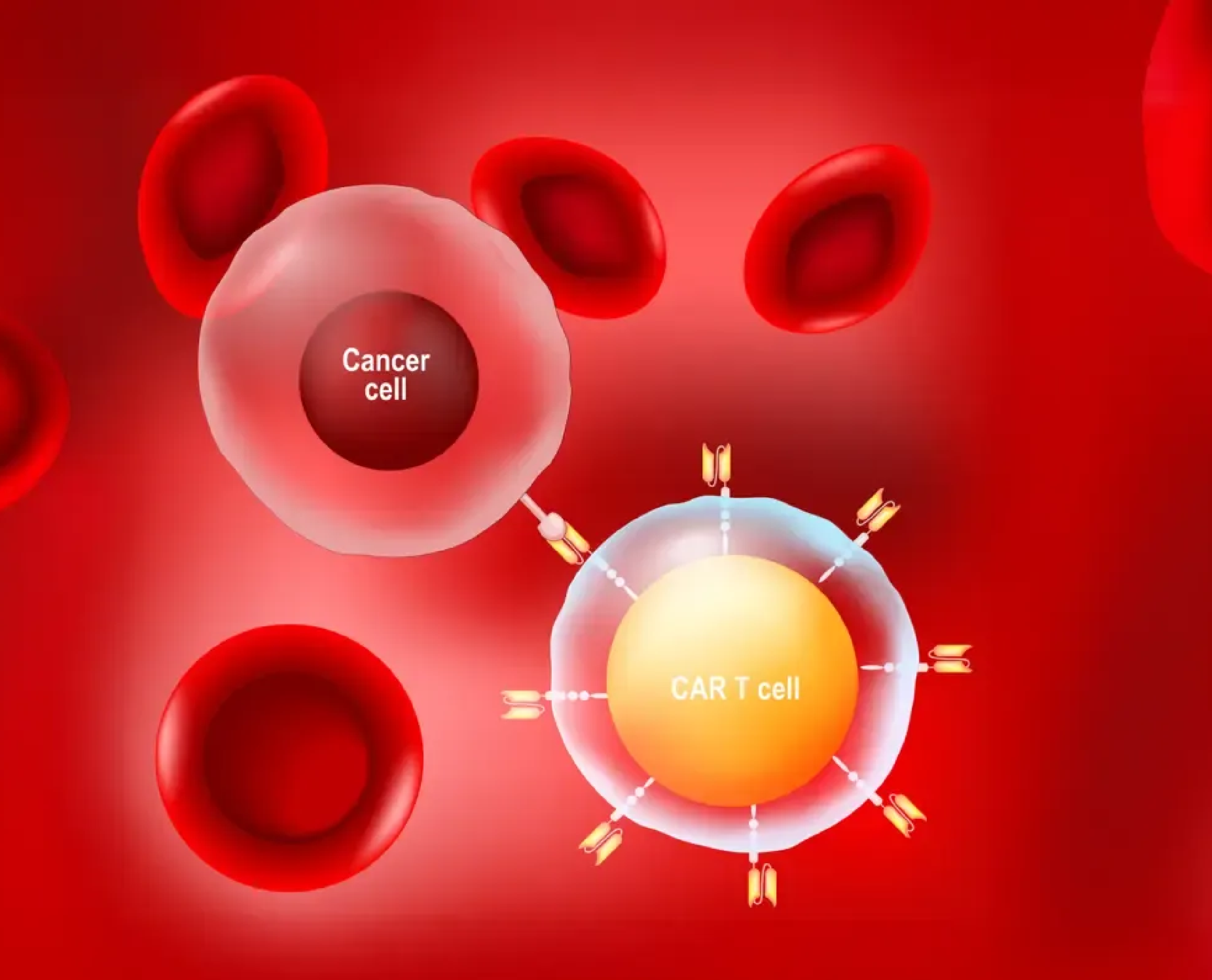 Kidney Cancer